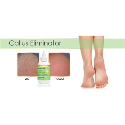 Be natural Средство для удаления натоптышей / Callus Eliminator, 29 мл